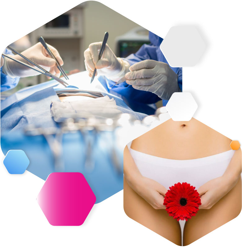 cancer-vulvar-2