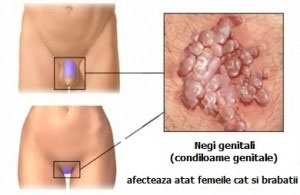 hpv